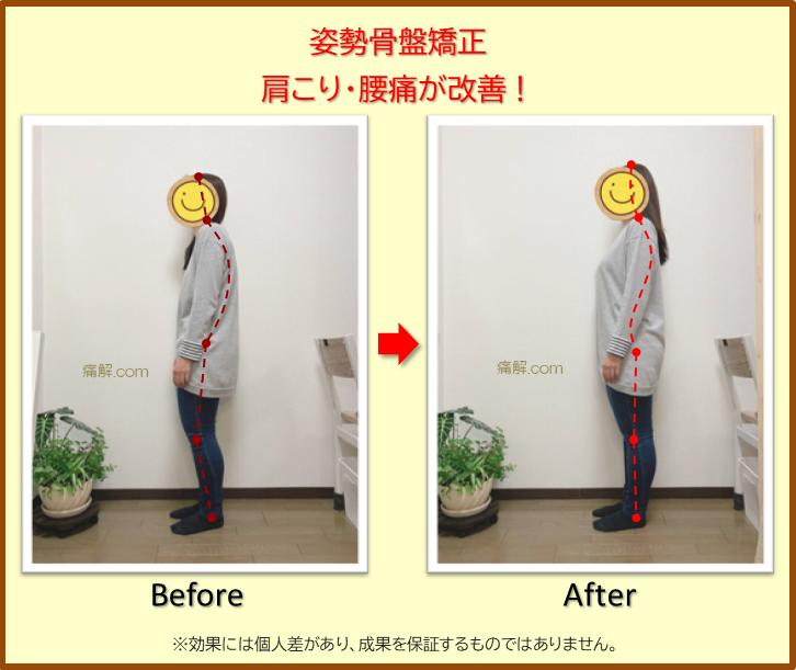 背骨・骨盤の歪み　ボキボキしない優しい施術で矯正　整体